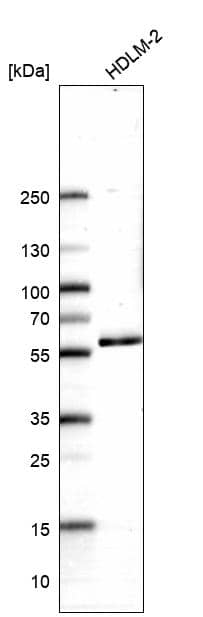 Analysis in human cell line HDLM-2.
