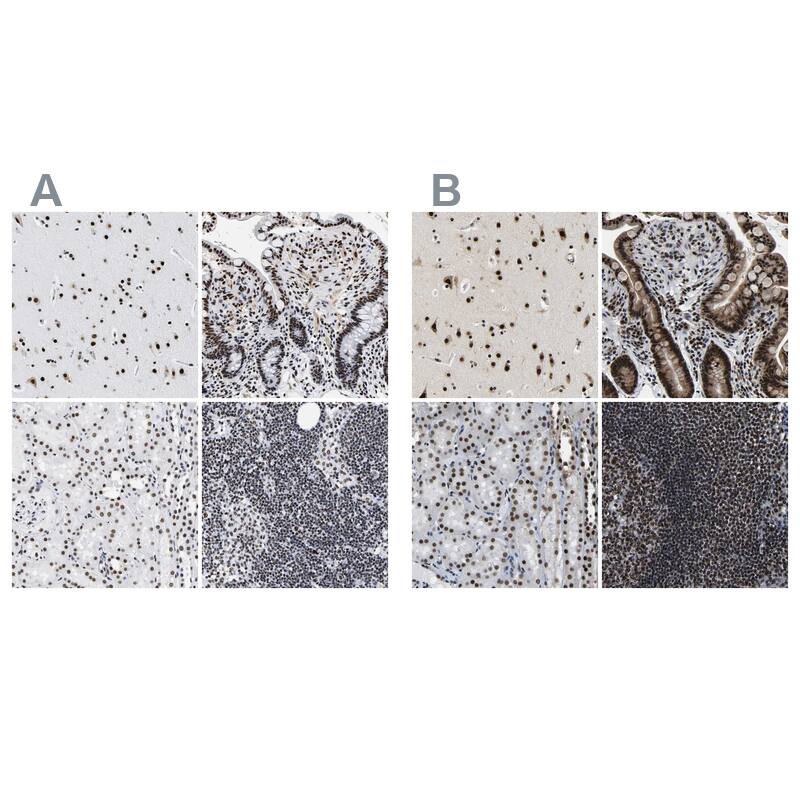 <b>Independent Antibodies Validation. </b>Staining of human cerebral cortex, gastrointestinal, kidney and lymphoid tissues using Anti-LUC7L3 antibody NBP1-88053 (A) shows similar protein distribution across tissues to independent antibody NBP1-88051 (B).