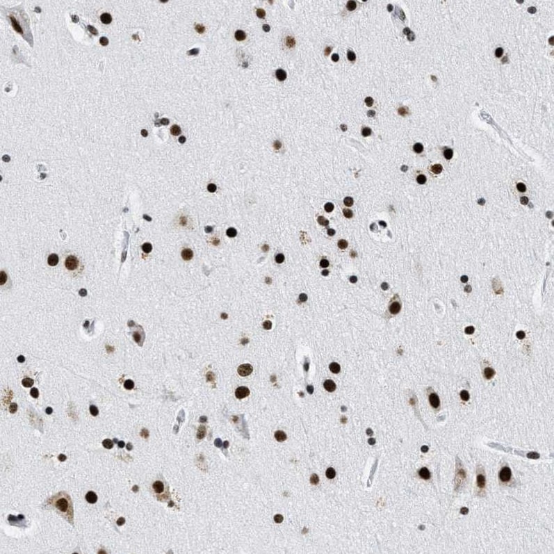 Staining of human cerebral cortex shows strong positivity in nuclear speckles in neurons.