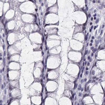 Staining of human colon using Anti-CRX antibody HPA036763.