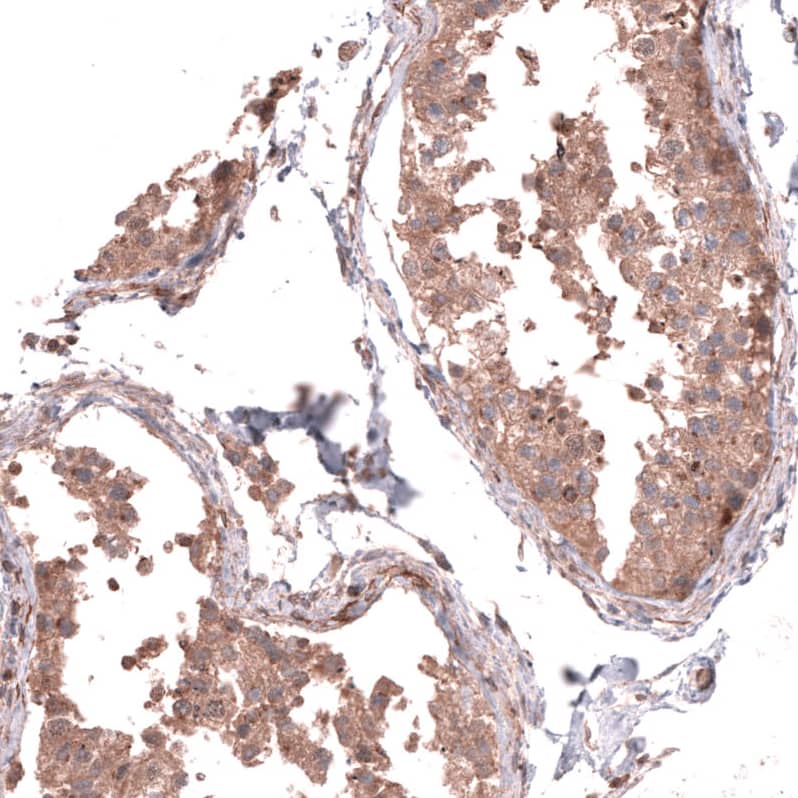 Immunohistochemistry-Paraffin Collagen XII alpha1 Antibody - BSA Free
