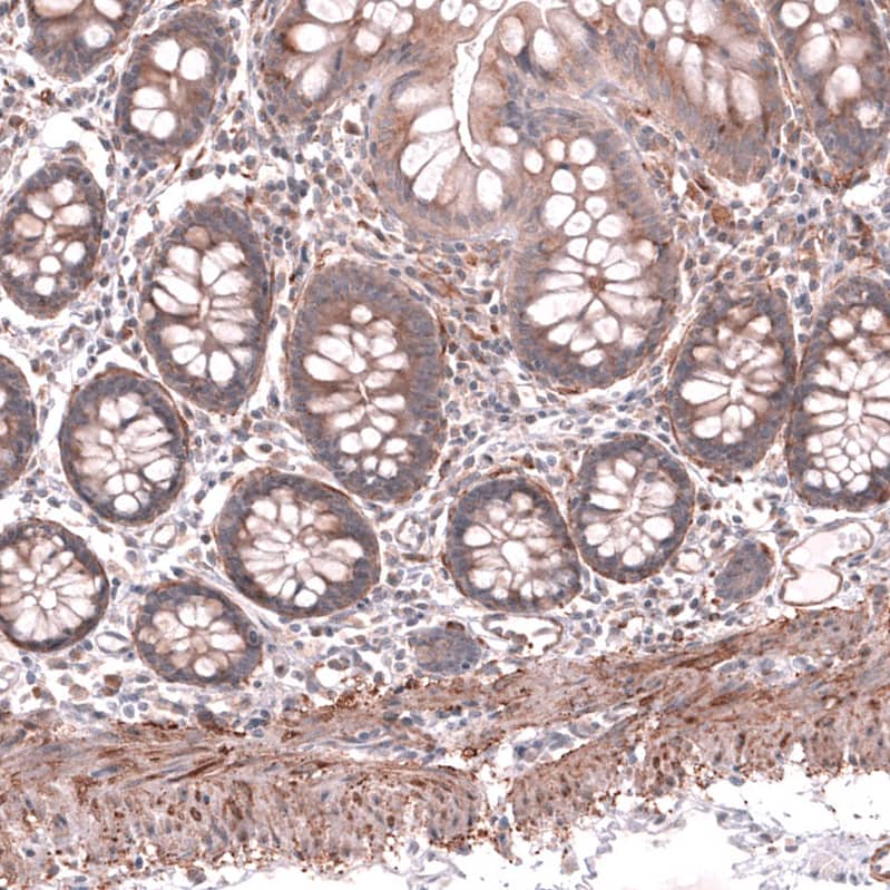 Immunohistochemistry-Paraffin Collagen XII alpha1 Antibody - BSA Free