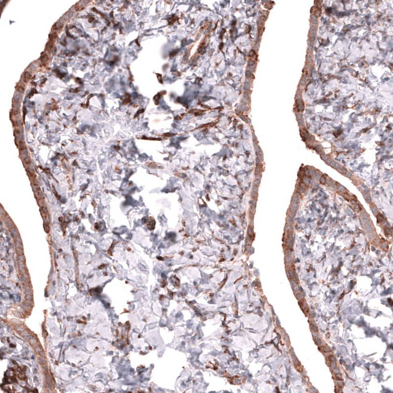 Immunohistochemistry-Paraffin Collagen XII alpha1 Antibody - BSA Free