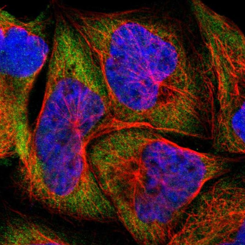 Staining of human cell line A-431 shows localization to cytosol.