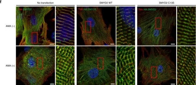 Immunocytochemistry/ Immunofluorescence: Titin Antibody [NBP1-88071] - SMYD2 Cys13 glutathionylation induces dissociation of SMYD2 from N2A & Hsp90. a, b SMYD2 glutathionylation disrupts its interaction with Hsp90. Purified SMYD2-SH & SMYD2-SSG were incubated with GST-Hsp90 bound to glutathione beads, & eluted sample was analyzed (a). Hsp90 was co-immunoprecipitated with SMYD2 WT or C13S from HEK293 cells in response to AMA with glucose deprivation (b). c, d SMYD2 glutathionylation disrupts its interaction with N2A. Purified SMYD2-SH & SMYD2-SSG were incubated with GST-N2A bound to glutathione beads, & eluted sample was analyzed (c). FLAG-N2A was co-immunoprecipitated with SMYD2 WT or C13S in HEK293 cells in response to AMA with glucose deprivation (d). e SMYD2 subjected to glutathionylation decreases its binding with N2A. SMYD2 WT or C13S was pre-incubated with H2O2 in the absence or presence of glutathione for 15 min, then mixed with GST-N2A bound to glutathione beads for 1 h. Eluted samples were analyzed. f, g Colocalization of titin & SMYD2 decreases upon incubation of AMA in rat neonatal cardiomyocytes expressing SMYD2 WT versus C13S. Immunostainings of cardiomyocytes with antibodies to titin ( alpha -titin-NT, red), HA, or SMYD2 (green) are shown with enlarged areas for details (the red boxes) (f). Pearson’s correlation coefficients were calculated to determine colocalization of titin & SMYD2 (g). About 30 cells were analyzed in individual conditions. Images represent the major colocalization pattern in individual experiments. Scale bars, 10 µm. Data represent the mean ± SD, n = 3 independent experiments Image collected & cropped by CiteAb from the following publication (//pubmed.ncbi.nlm.nih.gov/30337525), licensed under a CC-BY license. Not internally tested by Novus Biologicals.