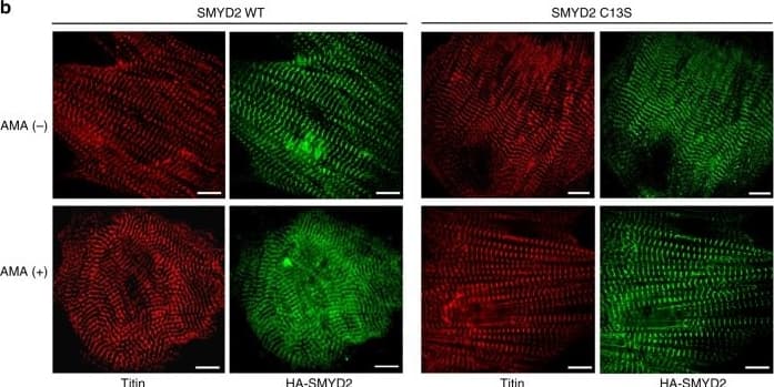 Immunocytochemistry/ Immunofluorescence: Titin Antibody [NBP1-88071] - SMYD2 Cys13 glutathionylation or oxidation reduces myofibril integrity. a, b Monitoring the myofibril alignment in rat neonatal cardiomyocytes upon incubation of AMA (2 µg/mL) for 12 h: no expression (a) & ectopic expression of SMYD2 WT or C13S (b). Immunostainings were done by using antibodies to SMYD2, HA (green), or titin ( alpha -titin-NT, red). About 30 cells were photographed & examined for myofibril alignment or directionality by FiberFit software.34 Images represent the major myofibril structure in individual conditions. Scale bars, 10 µm. c Analysis of myofibril alignment in cardiomyocytes. Individual cell images were analyzed by the FiberFit software to determine the fiber dispersion parameter (k) values that represent the degree of fiber alignment. High k values represent the aligned networks, whereas low k values represent the disordered networks. The median values with 95% CI are shown, n = 3 independent experiments. Difference is significant by one-way ANOVA, followed by Tukey’s post-hoc test, *p < 0.05, **p < 0.01, ***p < 0.001, ****p < 0.0001 Image collected & cropped by CiteAb from the following publication (//pubmed.ncbi.nlm.nih.gov/30337525), licensed under a CC-BY license. Not internally tested by Novus Biologicals.