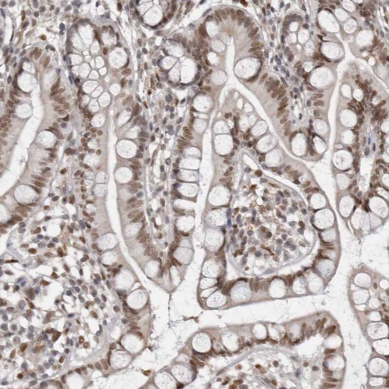 Staining of human small intestine shows strong nuclear positivity in glandular cells.
