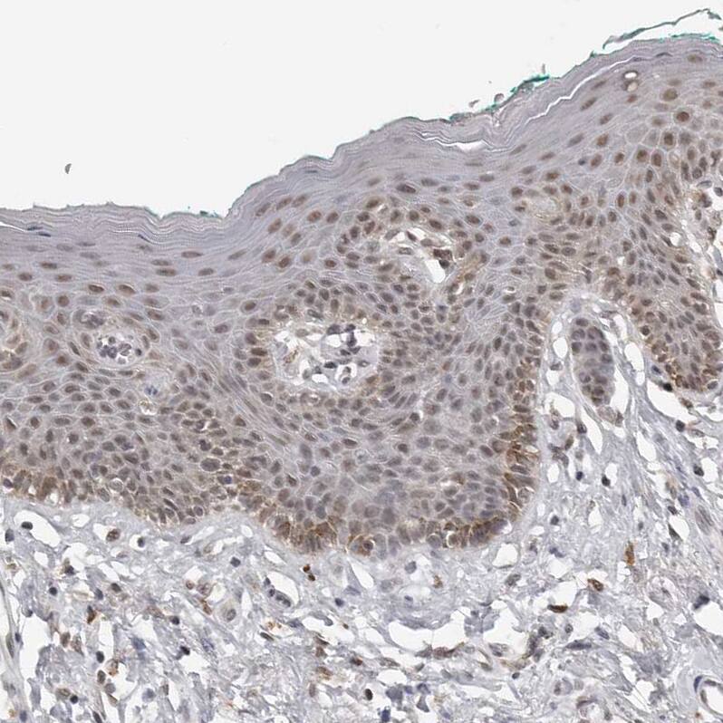 Staining of human skin shows moderate nuclear positivity in squamous epithelial cells.