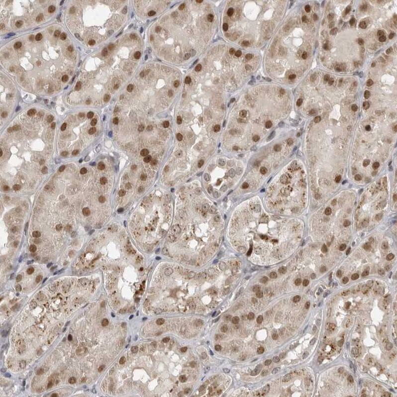 Staining of human kidney shows strong nuclear positivity in cells in tubules.