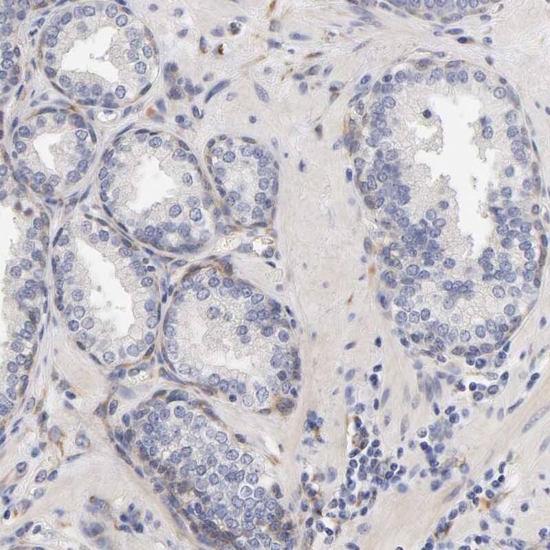 Staining of human prostate shows low expression as expected.