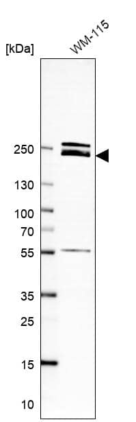 Analysis in human cell line WM-115.