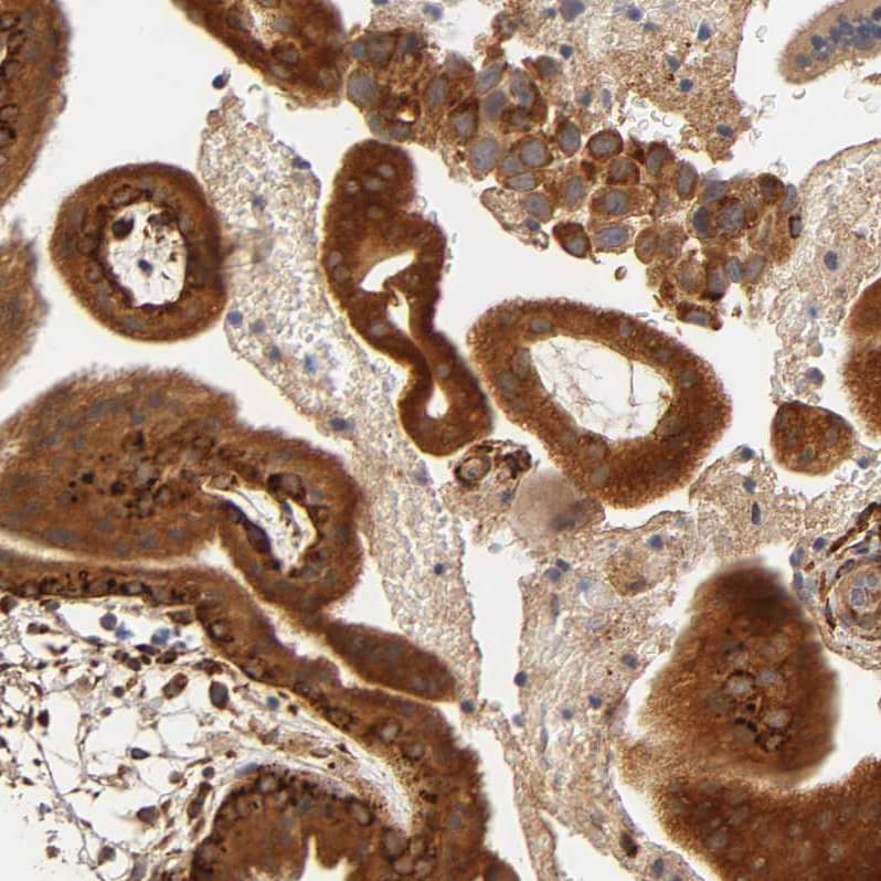 Staining of human placenta show strong cytoplasmic positivity in trophoblastic cells.