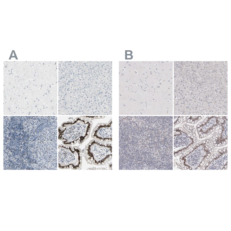<b>Independent Antibodies Validation. </b>Staining of human cerebral cortex, liver, lymph node and small intestine using Anti-ZBTB7B antibody NBP1-88077 (A) shows similar protein distribution across tissues to independent antibody NBP1-88078 (B).