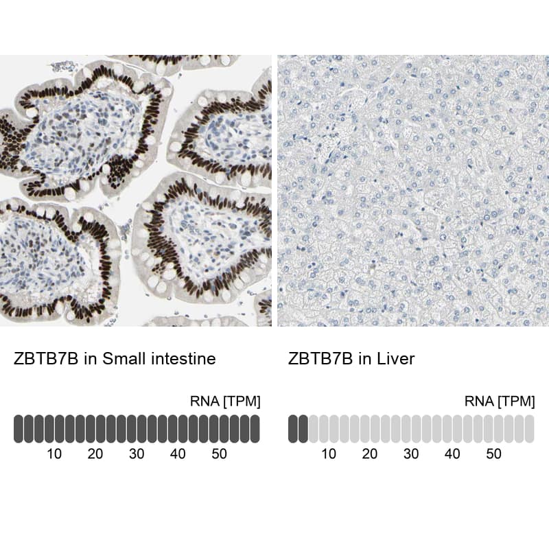 <b>Orthogonal Strategies Validation. </b>Analysis in human small intestine and liver tissues using HPA006811 antibody. Corresponding ZBTB7B RNA-seq data are presented for the same tissues.