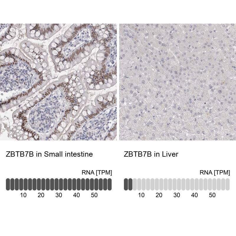 <b>Orthogonal Strategies Validation. </b>Analysis in human small intestine and liver tissues using HPA025820 antibody. Corresponding ZBTB7B RNA-seq data are presented for the same tissues.