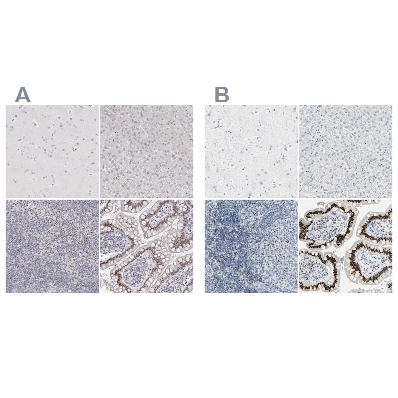 <b>Independent Antibodies Validation. </b>Staining of human cerebral cortex, liver, lymph node and small intestine using Anti-ZBTB7B antibody NBP1-88078 (A) shows similar protein distribution across tissues to independent antibody NBP1-88077 (B).
