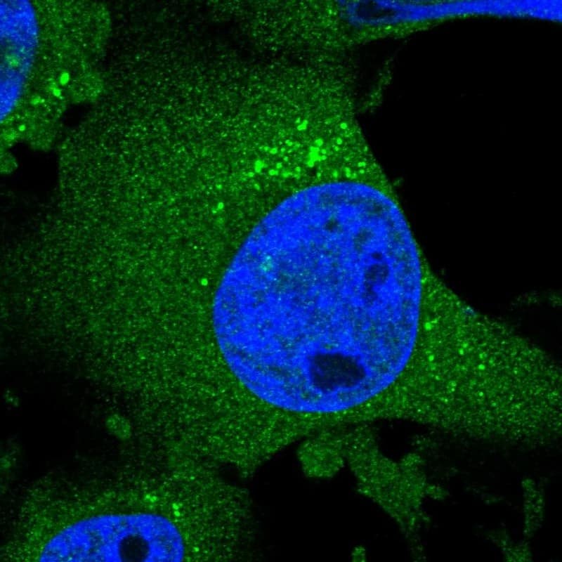 Immunocytochemistry/ Immunofluorescence CHSS2 Antibody - BSA Free