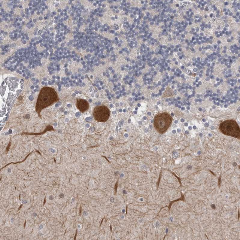 Staining of human cerebellum shows strong cytoplasmic positivity in purkinje cells.