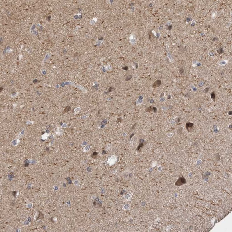 Staining of human cerebral cortex shows moderate cytoplasmic positivity in neurons.