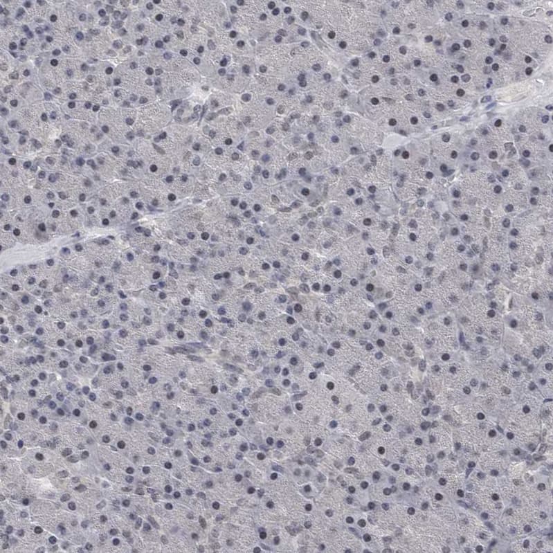Staining of human pancreas shows no positivity as expected.