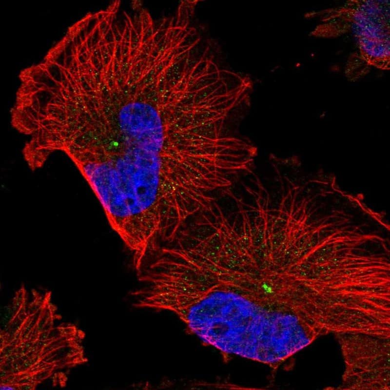 Immunocytochemistry/ Immunofluorescence RMD1 Antibody - BSA Free