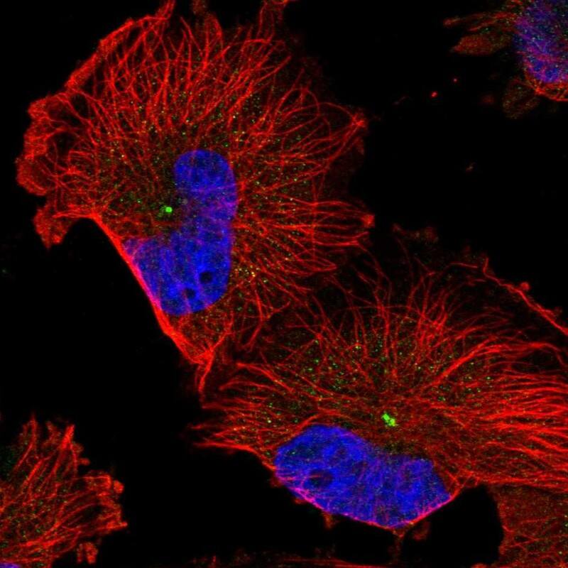 Immunocytochemistry/ Immunofluorescence RMD1 Antibody - BSA Free