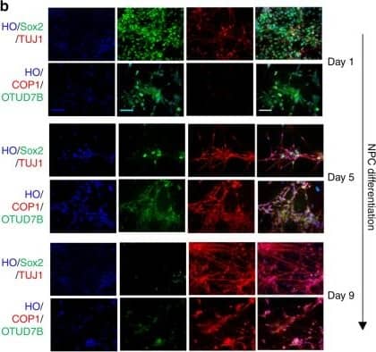 Western Blot: OTUD7B/Cezanne/ZA20D1 Antibody [NBP1-88095] - COP1 & OTUD7B coordinate to control NPCs differentiation. a, b NPCs were plated in Matrigel-coated six-well plate for neuronal differentiation. For the indicated times, immunoblotting (a) & immunofluorescence (b) of Sox2, CUL4A, COP1, OTUD7B & TUJ1 were performed. c Cells transfected with HA-Ub & indicated shRNA were treated by MG132 for 8 h, & the lysates were immunoprecipated with anti-Sox2 antibody & immunoblotted with anti-HA. d Summary of our findings. OTUD7B stabilizes Sox2 through deubiquitylation & maintains the stemness of NPCs, while CUL4ADET1-COP1 promotes Sox2 degradation through ubiquitylation & induces differentiation of NPCs. OTUD7B & CUL4ADET1-COP1 exert opposite roles in regulating Sox2 protein stability at the post-translational level. The representative images are shown from three independent experiments. Unprocessed original scans of blots are shown in Supplementary Fig. 9 Image collected & cropped by CiteAb from the following publication (//pubmed.ncbi.nlm.nih.gov/30405104), licensed under a CC-BY license. Not internally tested by Novus Biologicals.