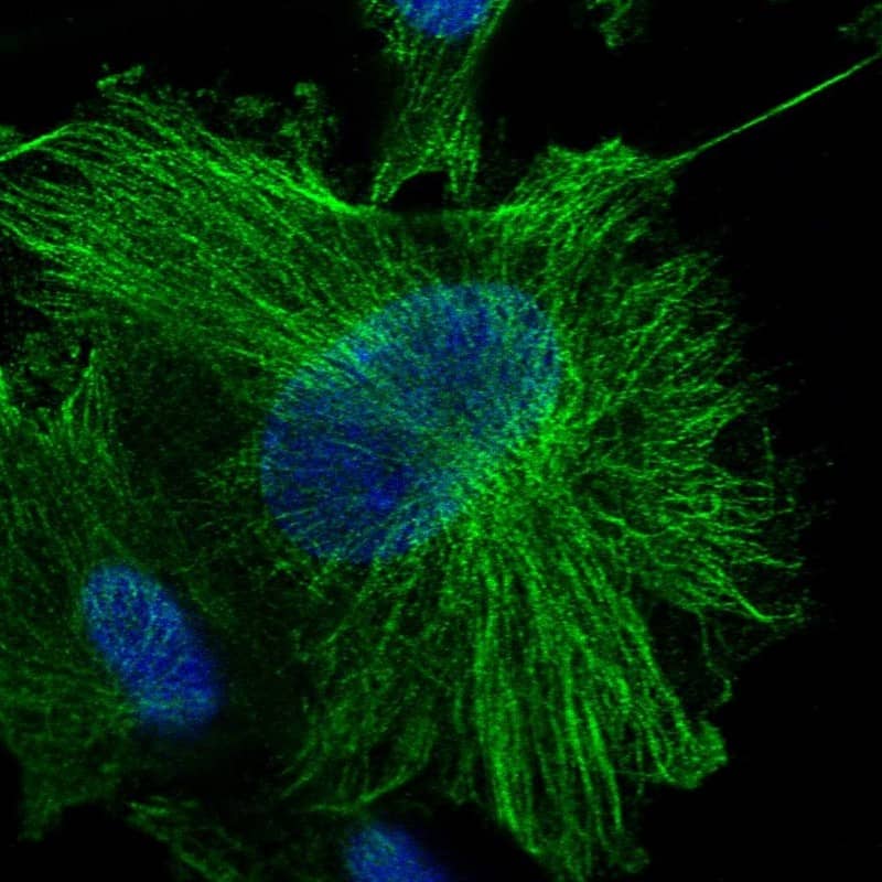 Staining of human cell line U-251 MG shows localization to nucleoplasm & microtubules.