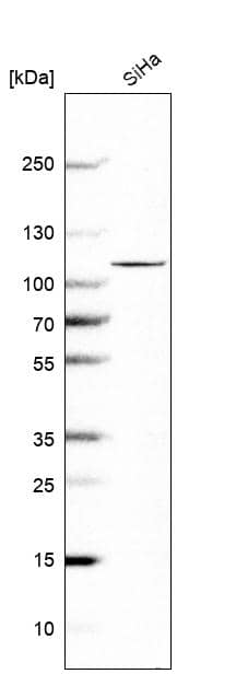 Analysis in human cell line SiHa.