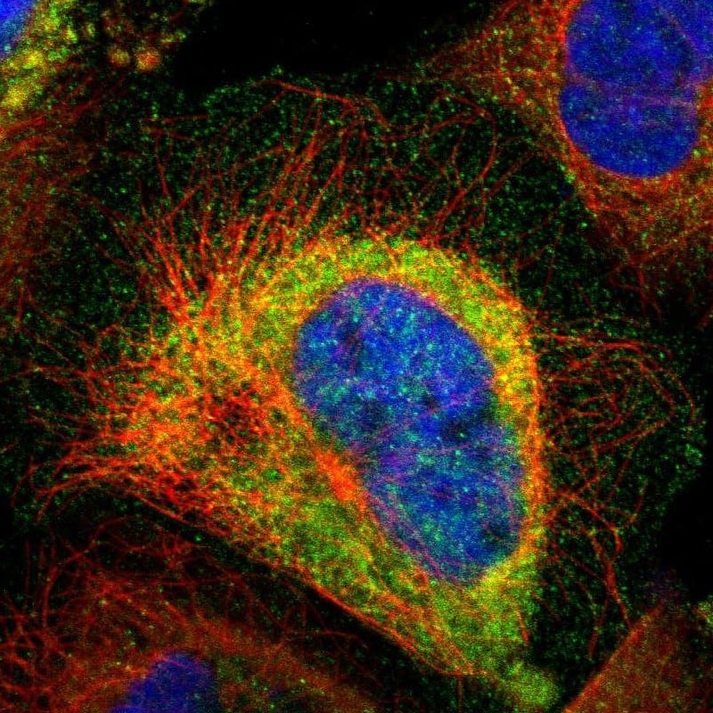 Staining of human cell line A-431 shows localization to plasma membrane & cytosol.