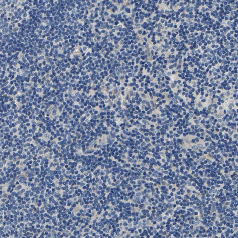 Staining of human Tonsil shows very weak cytoplasmic positivity in non-germinal center cells.