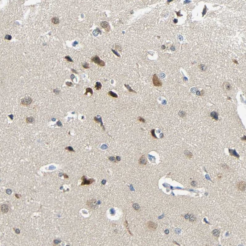 <b>Orthogonal Strategies Validation. </b>Staining of human Cerebral cortex shows moderate cytoplasmic and nuclear positivity in neuronal cells.