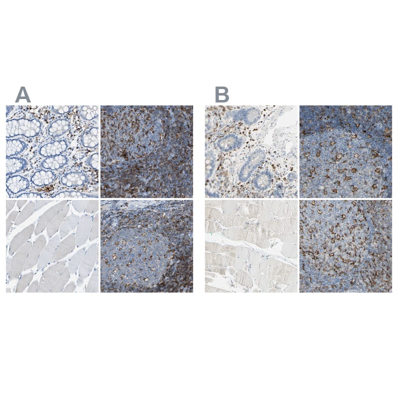 <b>Orthogonal Strategies Validation. </b>Staining of human gastrointestinal, lymph node, skeletal muscle and tonsil HPA016894 (A) shows similar protein distribution across tissues to independent antibody HPA008877 (B).