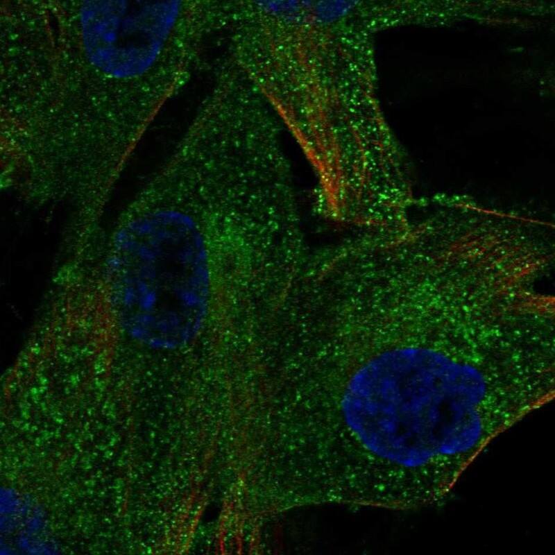 Staining of human cell line ASC TERT1 shows localization to the Golgi apparatus & vesicles.