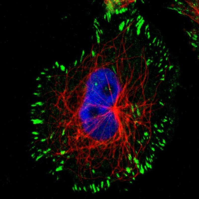 Staining of human cell line U-251 MG shows localization to focal adhesion sites.