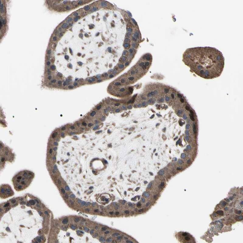 Staining of human placenta shows moderate cytoplasmic positivity in trophoblastic cells.