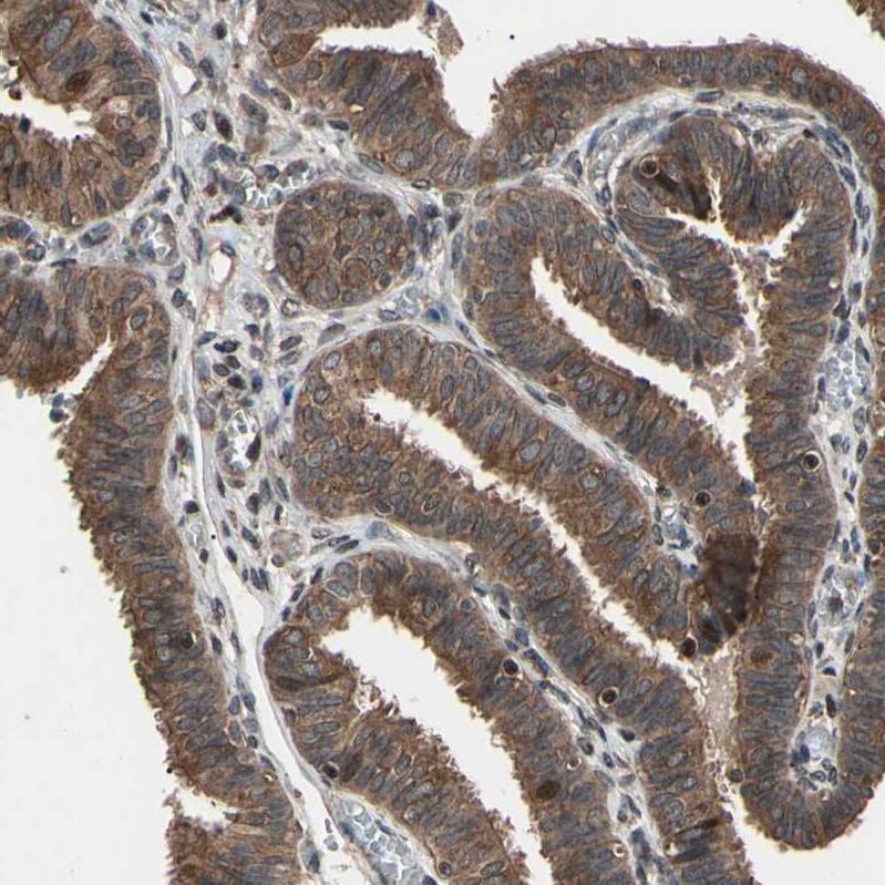 Staining of human fallopian tube shows moderate cytoplasmic positivity in glandular cells.