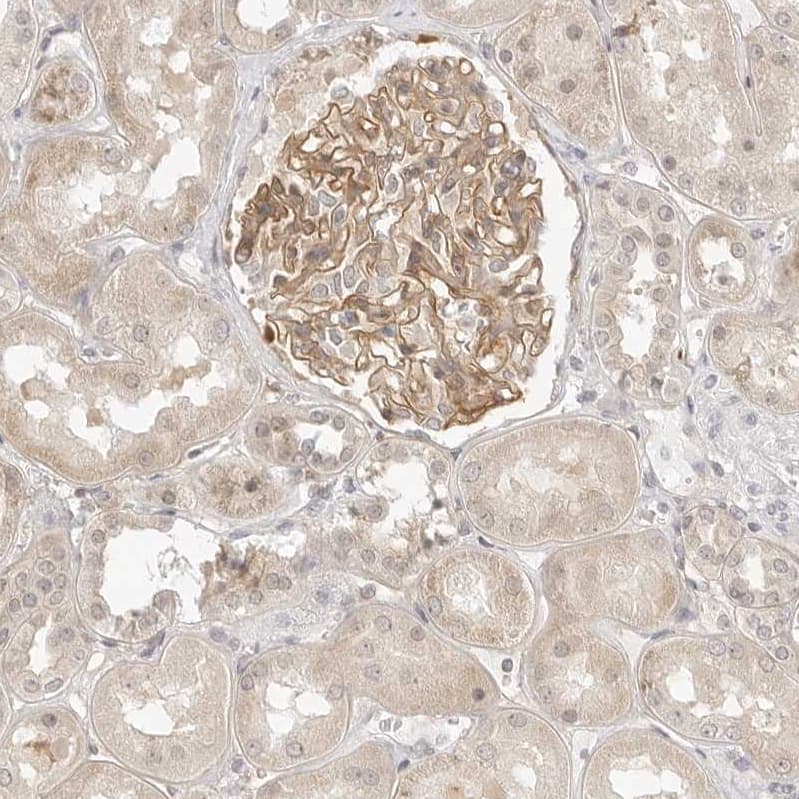 Staining of human kidney shows moderate cytoplasmic-membranous positivity in cells in glomeruli and weak cytoplasmic positivity in cells in tubules.