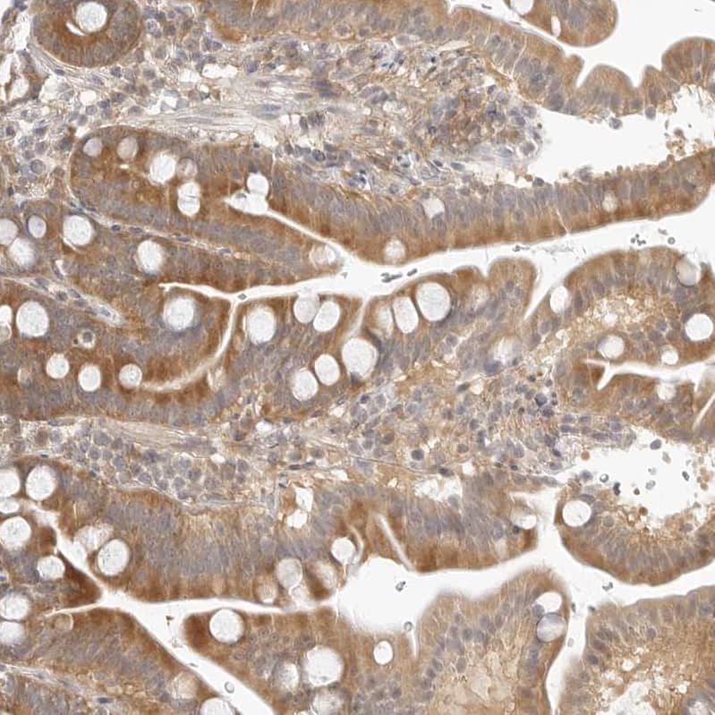Staining of human duodenum shows moderate cytoplasmic/membranous positivity in glandular cells.