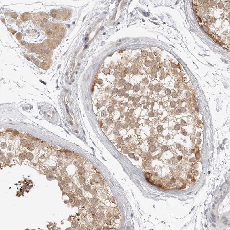 Staining of human testis shows moderate cytoplasmic positivity in cells in seminiferous ducts and Leydig cells.