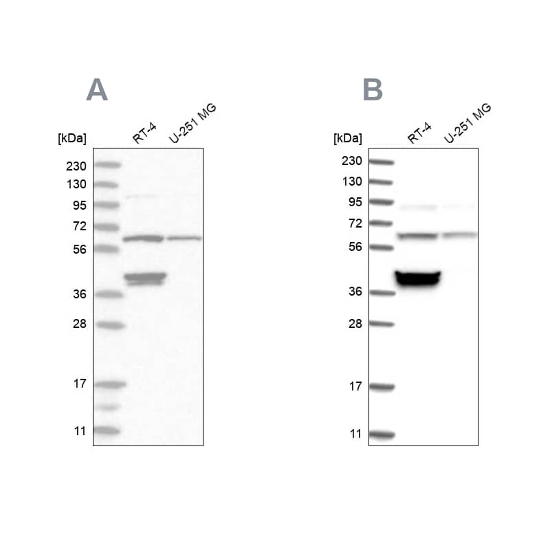 <b>Independent Antibodies Validation. </b>Analysis using Anti-TCP1 antibody NBP1-88148 (A) shows similar pattern to independent antibody NBP1-88149 (B).
