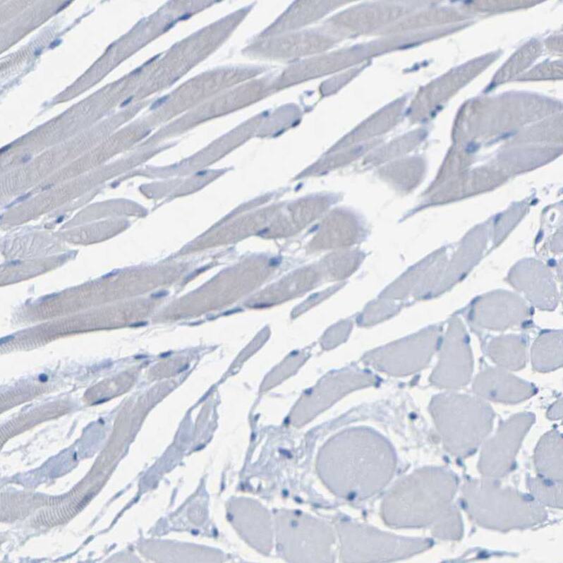 Staining of human skeletal muscle shows no cytoplasmic positivity in myocytes as expected.