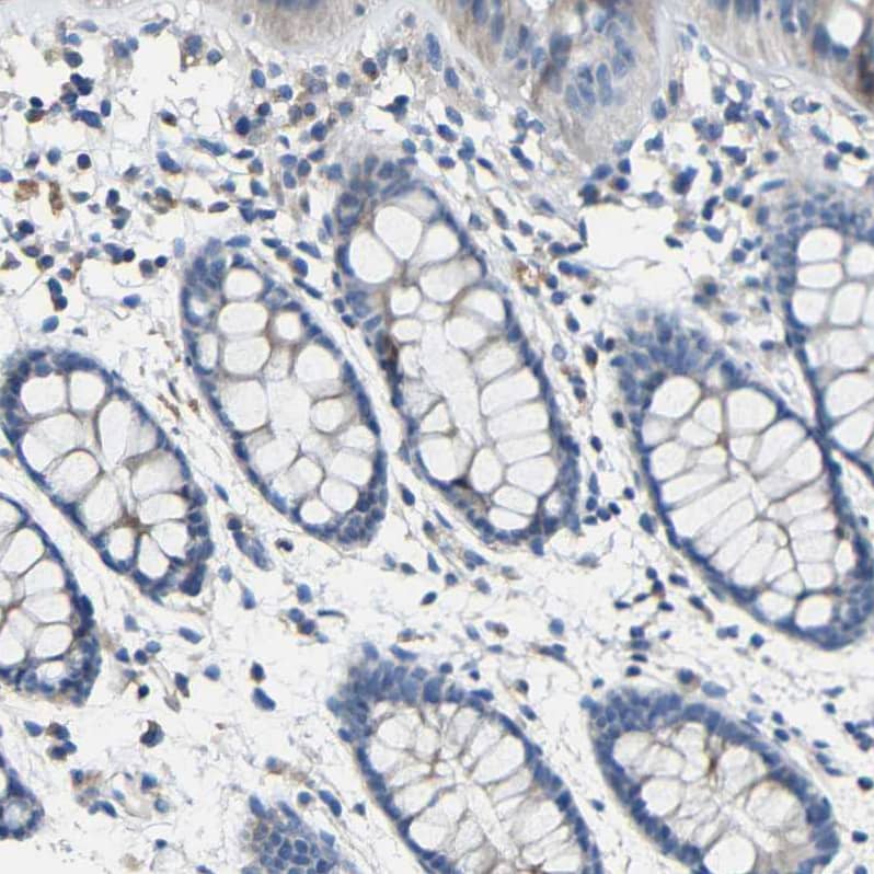 Staining of human rectum shows weak cytoplasmic positivity in glandular cells.