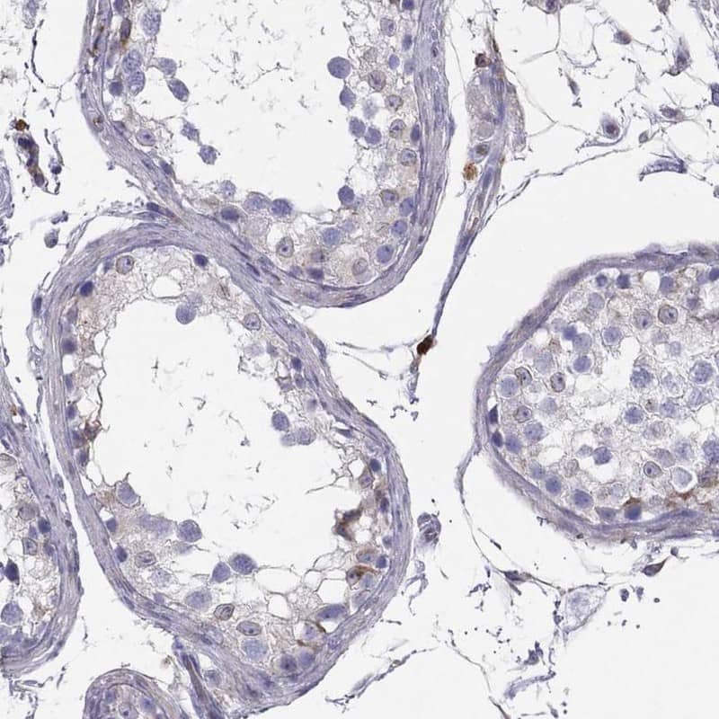 Staining of human testis shows moderate membranous positivity in subset of cells in seminiferous ducts.
