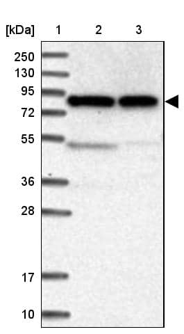 Lane 1: Marker [kDa] 250, 130, 95, 72, 55, 36, 28, 17, 10Lane 2: Human cell line RT-4Lane 3: Human cell line U-251MG sp