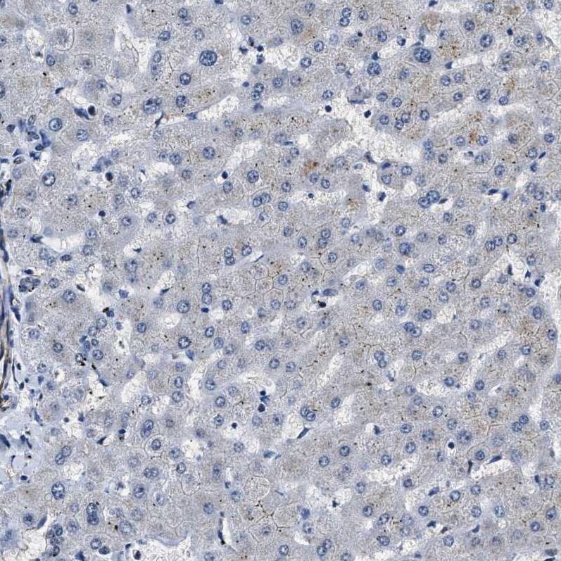 Staining of human liver shows no nuclear positivity in hepatocytes as expected.