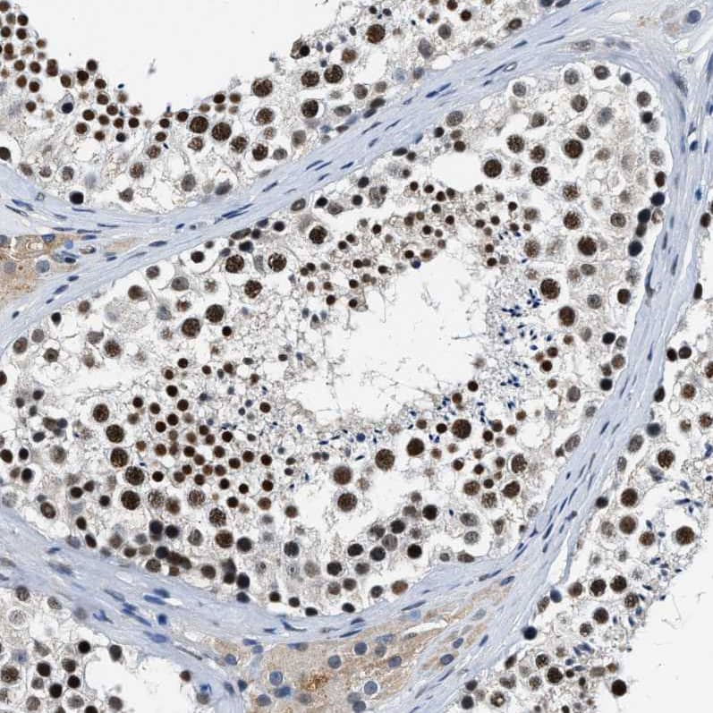 Staining of human testis shows strong nuclear positivity in cells in seminiferous ducts.