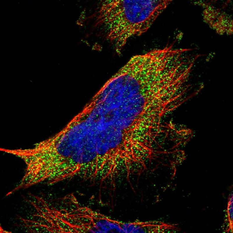 Staining of human cell line U-251 MG shows localization to vesicles.