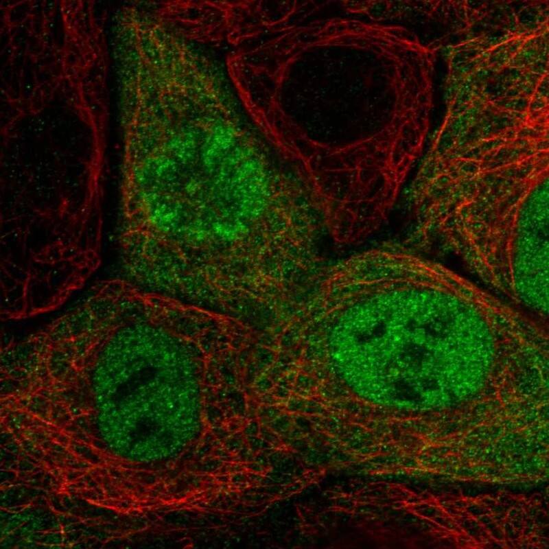 Staining of human cell line A-431 shows localization to nucleoplasm & cytosol.