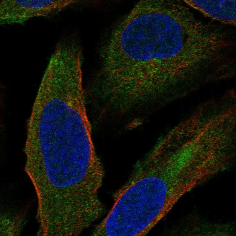 Staining of human cell line U-2 OS shows localization to cytosol & centrosome.